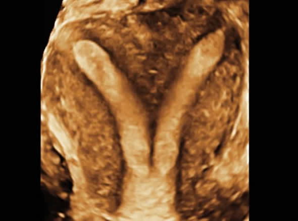 ganin Langone Medical Center: Scientists Initiate Nerve Repair in Multiple Sclerosis